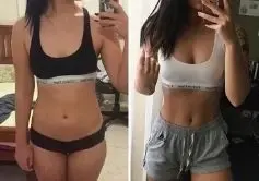 Comparativa antes y después de una mujer que redujo grasa abdominal