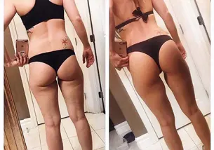 Comparativa antes y después de los glúteos de una mujer